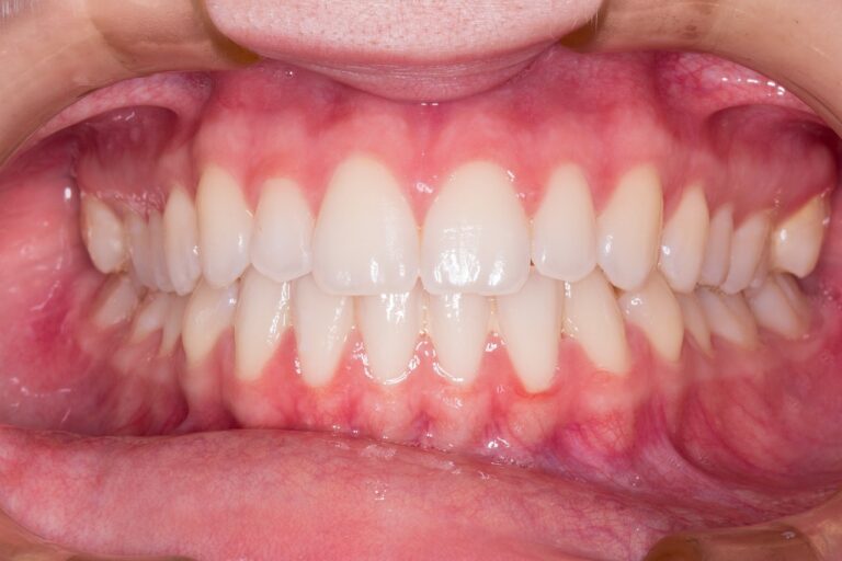 teeth, smile, dentist, teeth, teeth, dentist, dentist, dentist, dentist, dentist